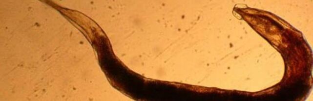 паразит от червеи от човешкото тяло