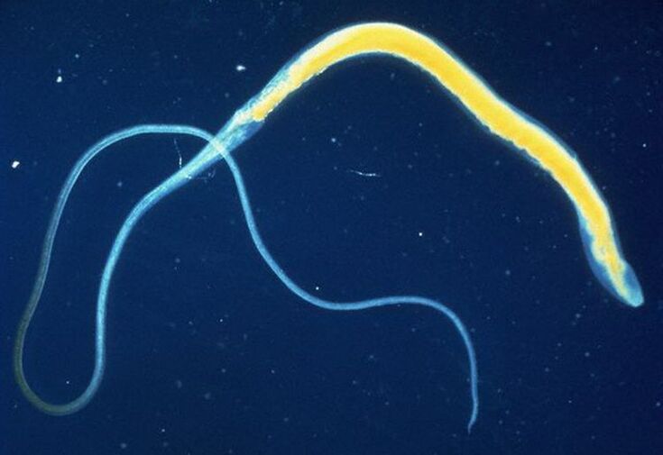 Whipworm е често срещан чревен паразит.