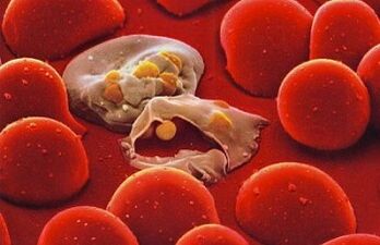 малария плазмодий в човешкото тяло